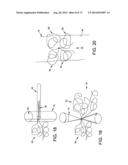 METHOD AND APPARATUS FOR OCCLUDING A BLOOD VESSEL AND/OR FOR OCCLUDING     OTHER TUBULAR STRUCTURES AND/OR FOR CLOSING OPENINGS IN STRUCTURES AND/OR     FOR SECURING AT LEAST TWO OBJECTS TOGETHER diagram and image