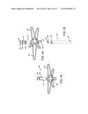 METHOD AND APPARATUS FOR OCCLUDING A BLOOD VESSEL AND/OR FOR OCCLUDING     OTHER TUBULAR STRUCTURES AND/OR FOR CLOSING OPENINGS IN STRUCTURES AND/OR     FOR SECURING AT LEAST TWO OBJECTS TOGETHER diagram and image