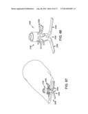 METHOD AND APPARATUS FOR OCCLUDING A BLOOD VESSEL AND/OR FOR OCCLUDING     OTHER TUBULAR STRUCTURES AND/OR FOR CLOSING OPENINGS IN STRUCTURES AND/OR     FOR SECURING AT LEAST TWO OBJECTS TOGETHER diagram and image