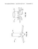 METHOD AND APPARATUS FOR OCCLUDING A BLOOD VESSEL AND/OR FOR OCCLUDING     OTHER TUBULAR STRUCTURES AND/OR FOR CLOSING OPENINGS IN STRUCTURES AND/OR     FOR SECURING AT LEAST TWO OBJECTS TOGETHER diagram and image