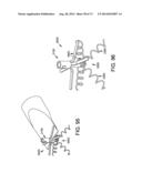 METHOD AND APPARATUS FOR OCCLUDING A BLOOD VESSEL AND/OR FOR OCCLUDING     OTHER TUBULAR STRUCTURES AND/OR FOR CLOSING OPENINGS IN STRUCTURES AND/OR     FOR SECURING AT LEAST TWO OBJECTS TOGETHER diagram and image