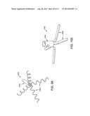 METHOD AND APPARATUS FOR OCCLUDING A BLOOD VESSEL AND/OR FOR OCCLUDING     OTHER TUBULAR STRUCTURES AND/OR FOR CLOSING OPENINGS IN STRUCTURES AND/OR     FOR SECURING AT LEAST TWO OBJECTS TOGETHER diagram and image