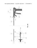 METHOD AND APPARATUS FOR OCCLUDING A BLOOD VESSEL AND/OR FOR OCCLUDING     OTHER TUBULAR STRUCTURES AND/OR FOR CLOSING OPENINGS IN STRUCTURES AND/OR     FOR SECURING AT LEAST TWO OBJECTS TOGETHER diagram and image