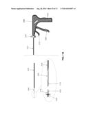 METHOD AND APPARATUS FOR OCCLUDING A BLOOD VESSEL AND/OR FOR OCCLUDING     OTHER TUBULAR STRUCTURES AND/OR FOR CLOSING OPENINGS IN STRUCTURES AND/OR     FOR SECURING AT LEAST TWO OBJECTS TOGETHER diagram and image