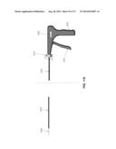 METHOD AND APPARATUS FOR OCCLUDING A BLOOD VESSEL AND/OR FOR OCCLUDING     OTHER TUBULAR STRUCTURES AND/OR FOR CLOSING OPENINGS IN STRUCTURES AND/OR     FOR SECURING AT LEAST TWO OBJECTS TOGETHER diagram and image