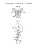 APPARATUS AND METHOD FOR HEART VALVE REPAIR diagram and image