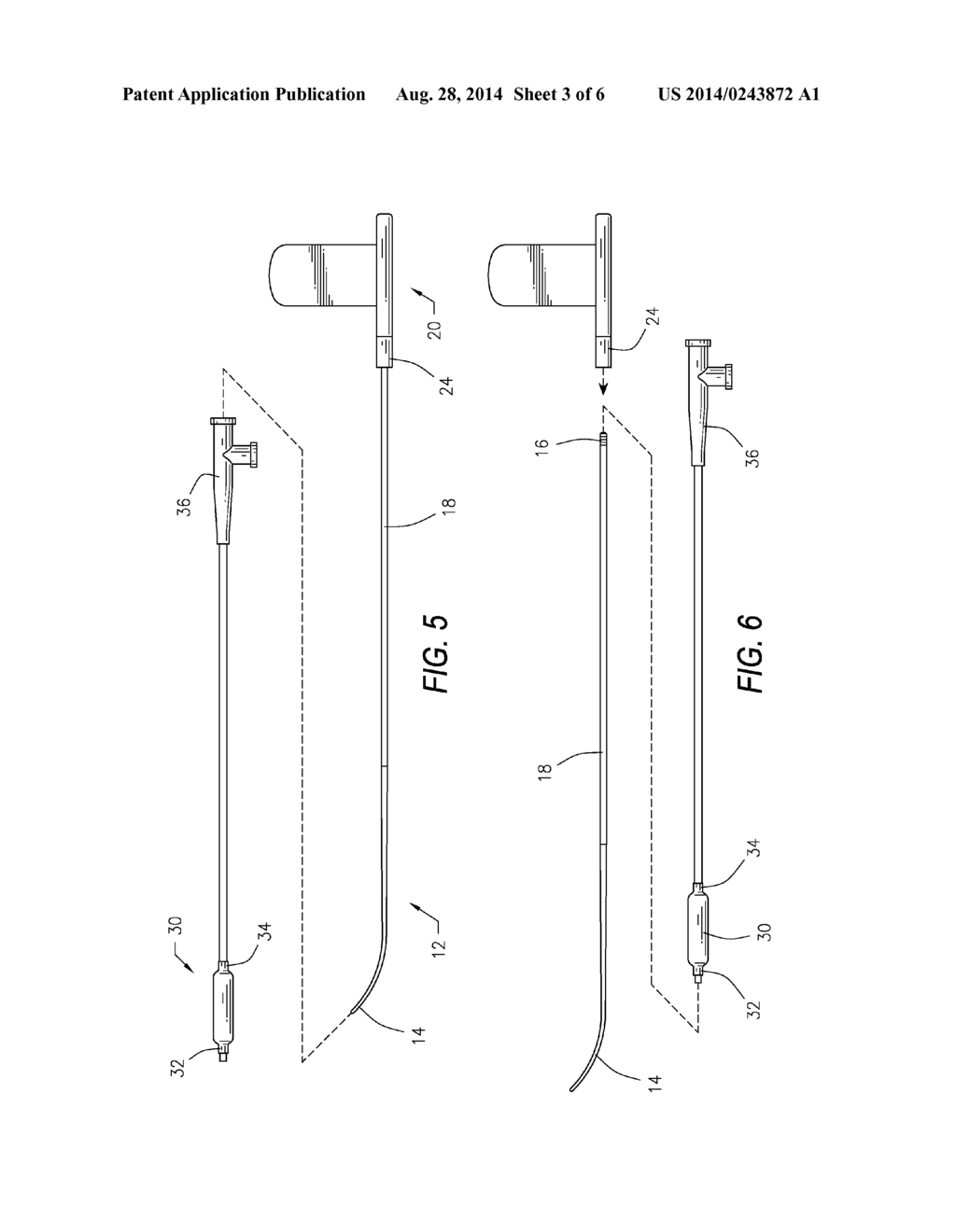 REUSABLE SINUS DILATION INSTRUMENT AND METHOD OF USE - diagram, schematic, and image 04