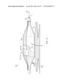 NON-COMPLIANT MEDICAL BALLOON diagram and image