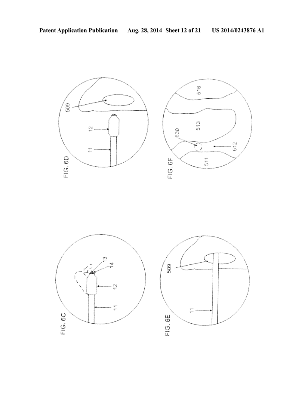 METHODS FOR TREATING SINUS OSTIA USING BALLOON CATHETER DEVICES HAVING A     BENDABLE BALLOON PORTION - diagram, schematic, and image 13