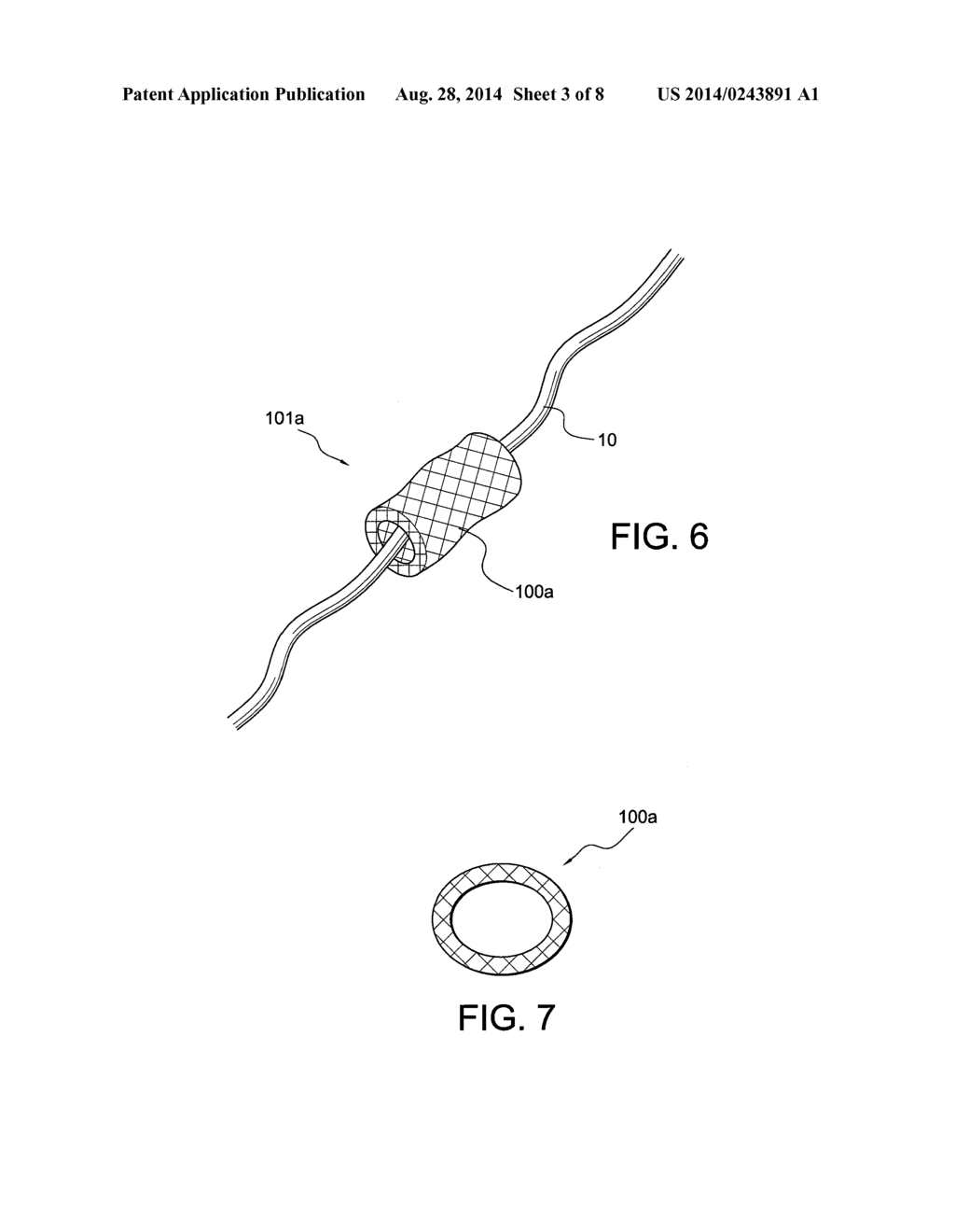 TISSUE PROTECTOR SUTURE CONSTRUCTS - diagram, schematic, and image 04