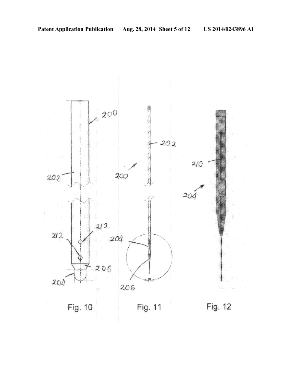 SYSTEMS AND METHODS FOR FACET JOINT TREATMENT - diagram, schematic, and image 06