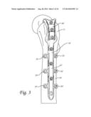 Periprosthetic Fracture Repair System Including Discrete Stabilized Crimp     Lugs for Cerclage Cable and Tool Therefor diagram and image