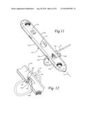 Periprosthetic Fracture Repair System Including Discrete Stabilized Crimp     Lugs for Cerclage Cable and Tool Therefor diagram and image