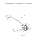 Periprosthetic Fracture Repair System Including Discrete Stabilized Crimp     Lugs for Cerclage Cable and Tool Therefor diagram and image