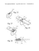 Periprosthetic Fracture Repair System Including Discrete Stabilized Crimp     Lugs for Cerclage Cable and Tool Therefor diagram and image