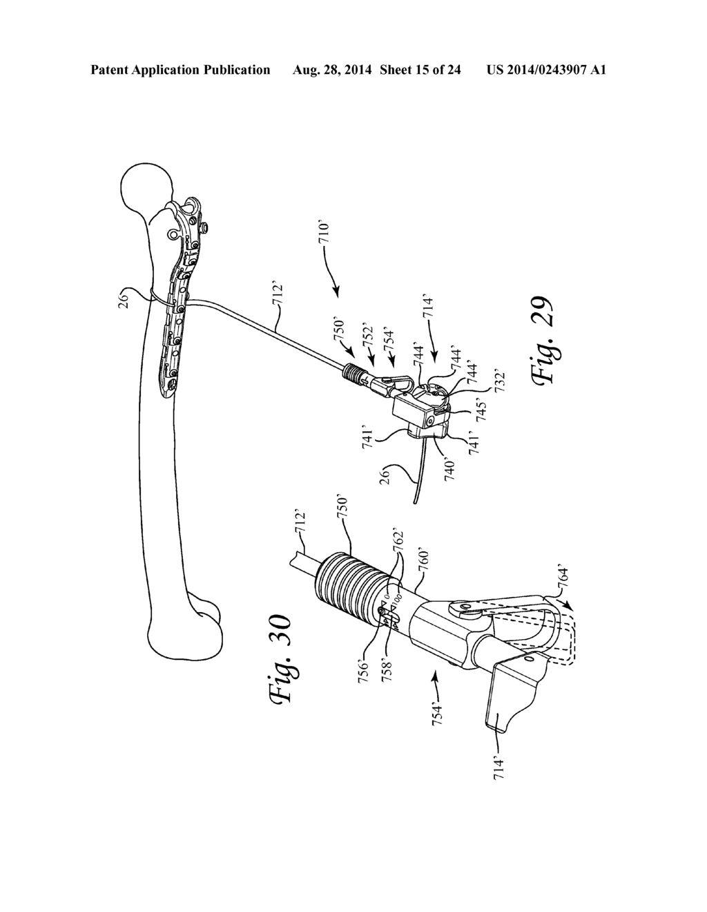 Periprosthetic Fracture Repair System Including Discrete Stabilized Crimp     Lugs for Cerclage Cable and Tool Therefor - diagram, schematic, and image 16