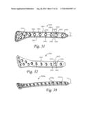 Periprosthetic Fracture Repair System Including Discrete Stabilized Crimp     Lugs for Cerclage Cable and Tool Therefor diagram and image