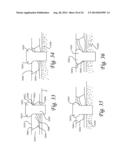 Periprosthetic Fracture Repair System Including Discrete Stabilized Crimp     Lugs for Cerclage Cable and Tool Therefor diagram and image