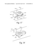 Periprosthetic Fracture Repair System Including Discrete Stabilized Crimp     Lugs for Cerclage Cable and Tool Therefor diagram and image