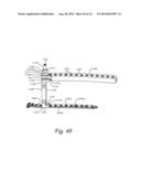 Periprosthetic Fracture Repair System Including Discrete Stabilized Crimp     Lugs for Cerclage Cable and Tool Therefor diagram and image