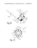 Periprosthetic Fracture Repair System Including Discrete Stabilized Crimp     Lugs for Cerclage Cable and Tool Therefor diagram and image