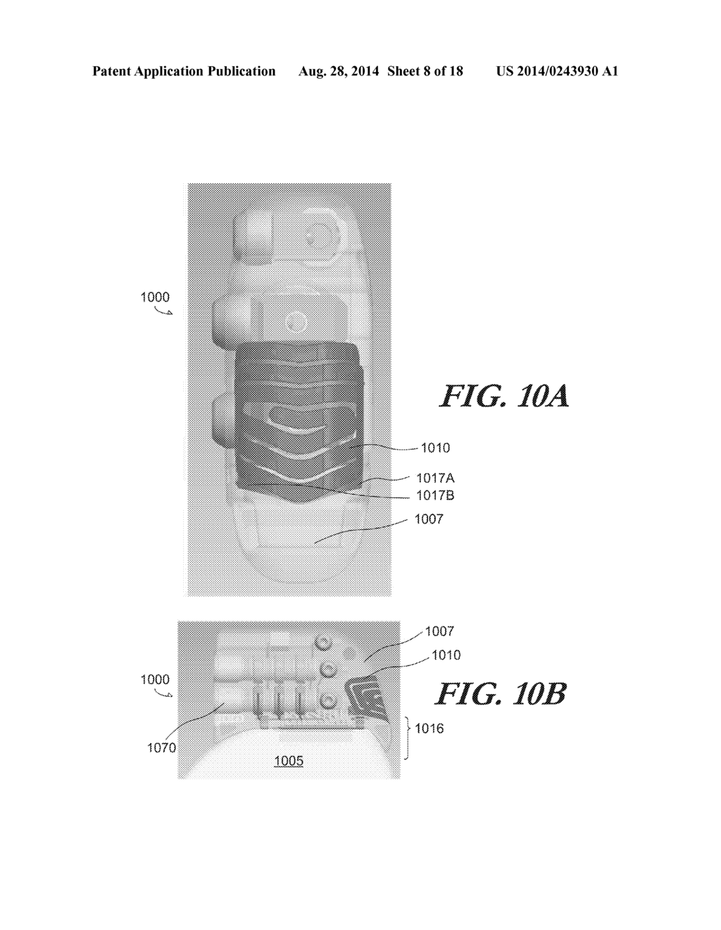 FOLDED ANTENNAS FOR IMPLANTABLE MEDICAL DEVICES - diagram, schematic, and image 09