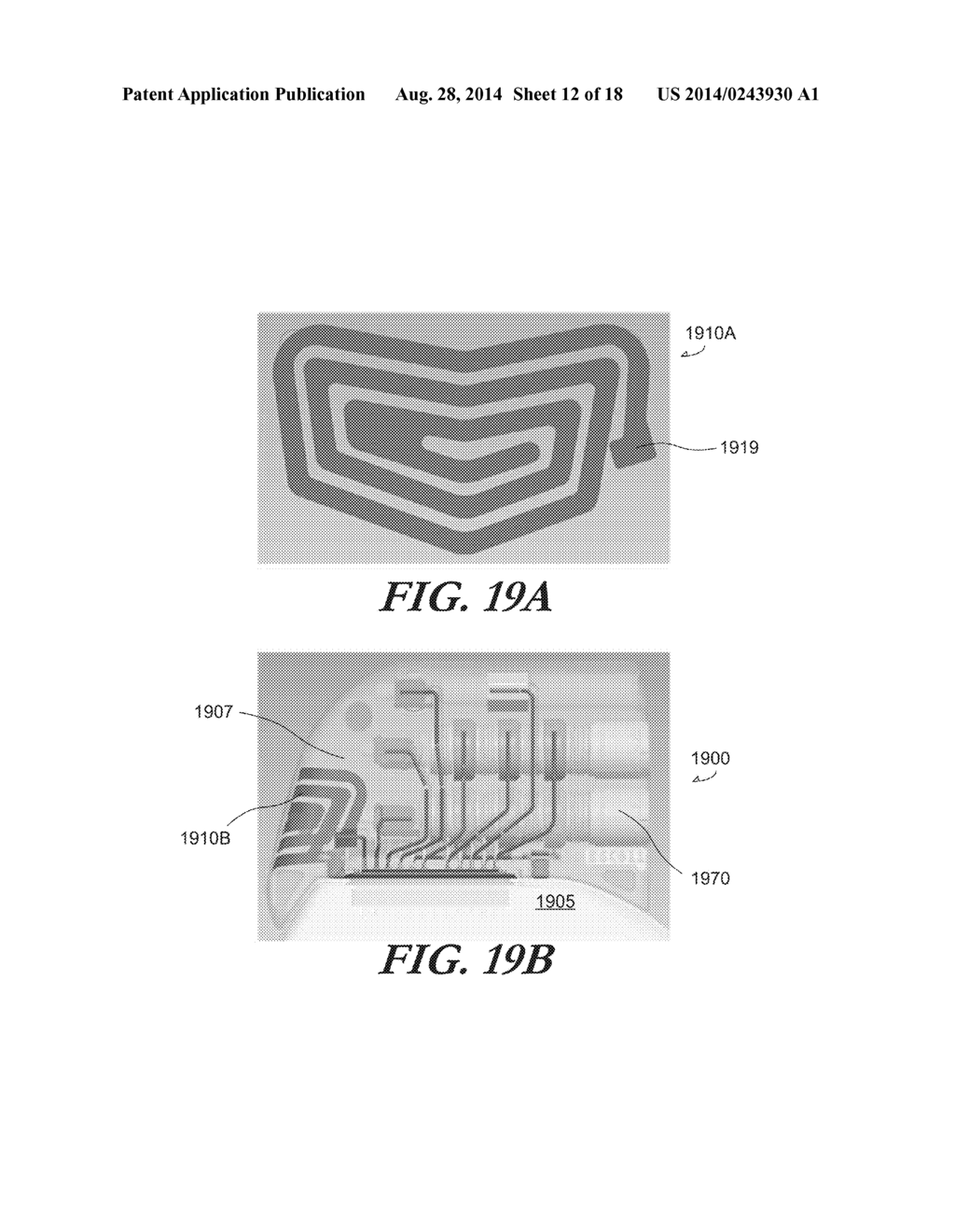 FOLDED ANTENNAS FOR IMPLANTABLE MEDICAL DEVICES - diagram, schematic, and image 13