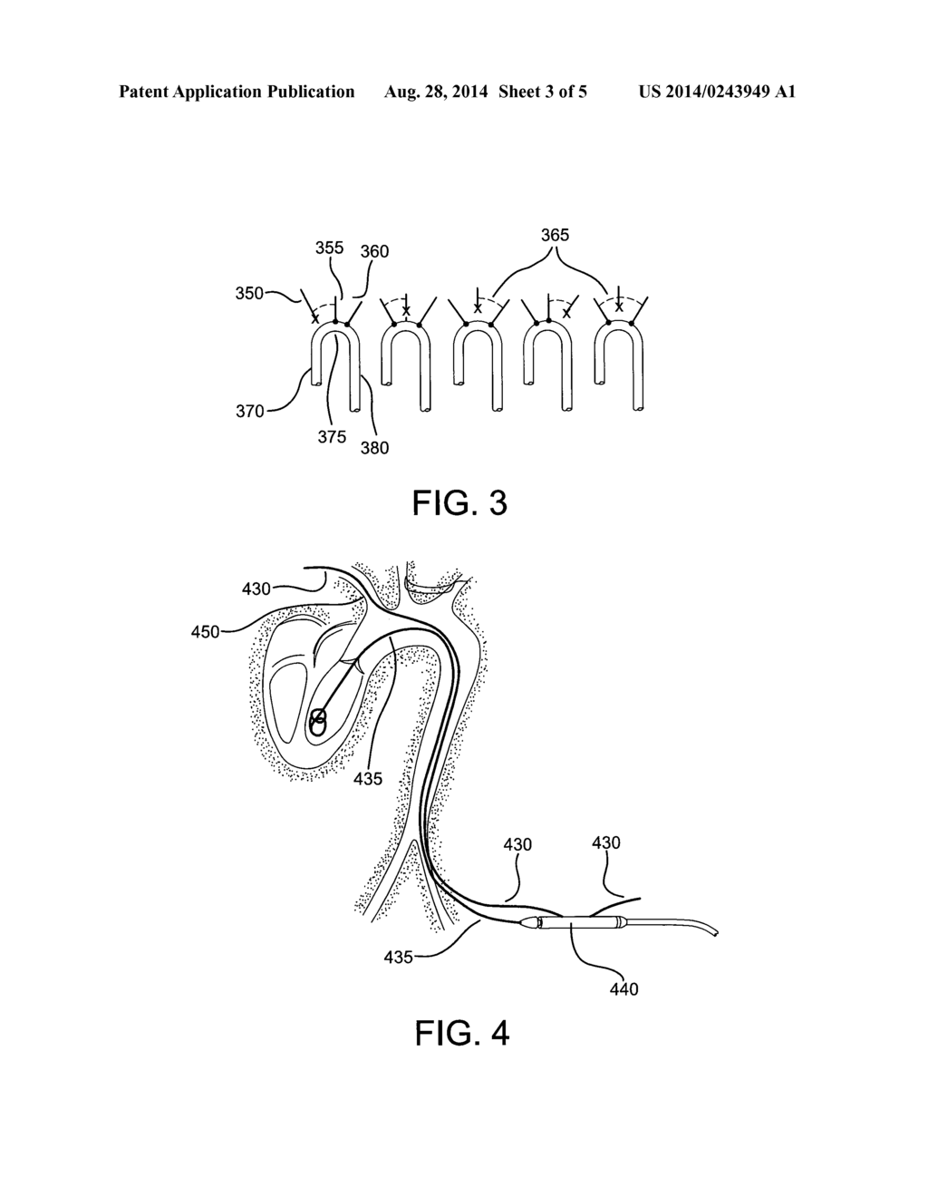 STENT-GRAFT HAVING FACING SIDE BRANCH PORTALS - diagram, schematic, and image 04