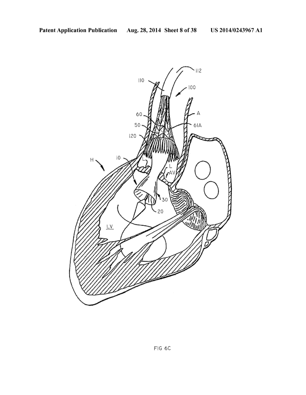 Methods and Apparatus for Endovascular Heart Valve Replacement Comprising     Tissue Grasping Elements - diagram, schematic, and image 09