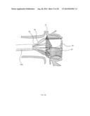 Methods and Apparatus for Endovascular Heart Valve Replacement Comprising     Tissue Grasping Elements diagram and image