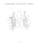 Methods and Apparatus for Endovascular Heart Valve Replacement Comprising     Tissue Grasping Elements diagram and image