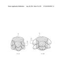 Methods and Apparatus for Endovascular Heart Valve Replacement Comprising     Tissue Grasping Elements diagram and image