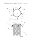 Methods and Apparatus for Endovascular Heart Valve Replacement Comprising     Tissue Grasping Elements diagram and image