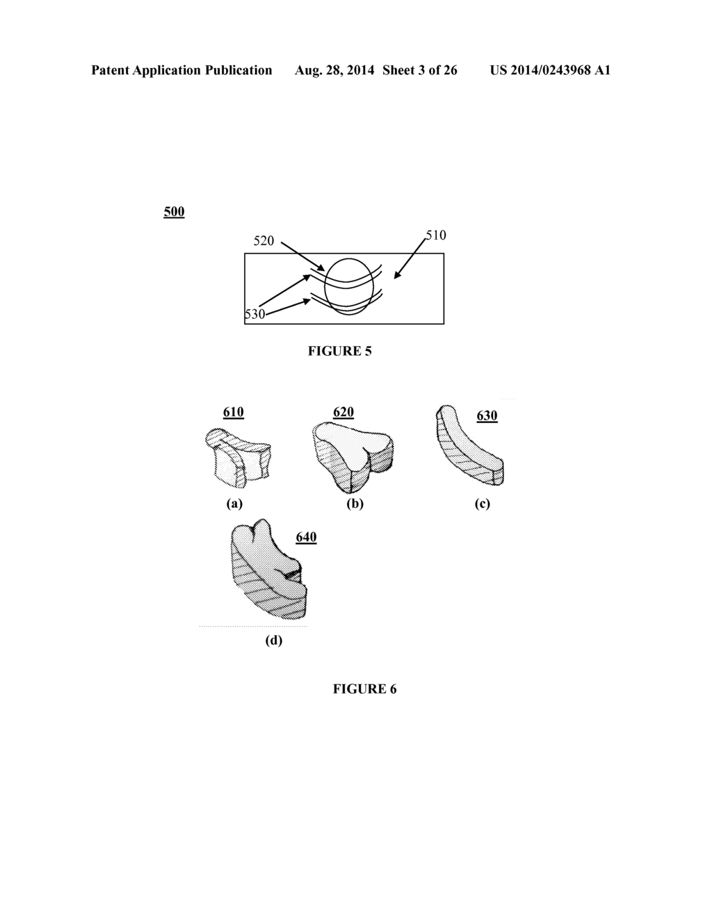 SYSTEMS, DEVICES AND METHODS FOR REPAIR OF HEART VALVE LESIONS - diagram, schematic, and image 04