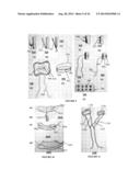 SYSTEMS, DEVICES AND METHODS FOR REPAIR OF HEART VALVE LESIONS diagram and image