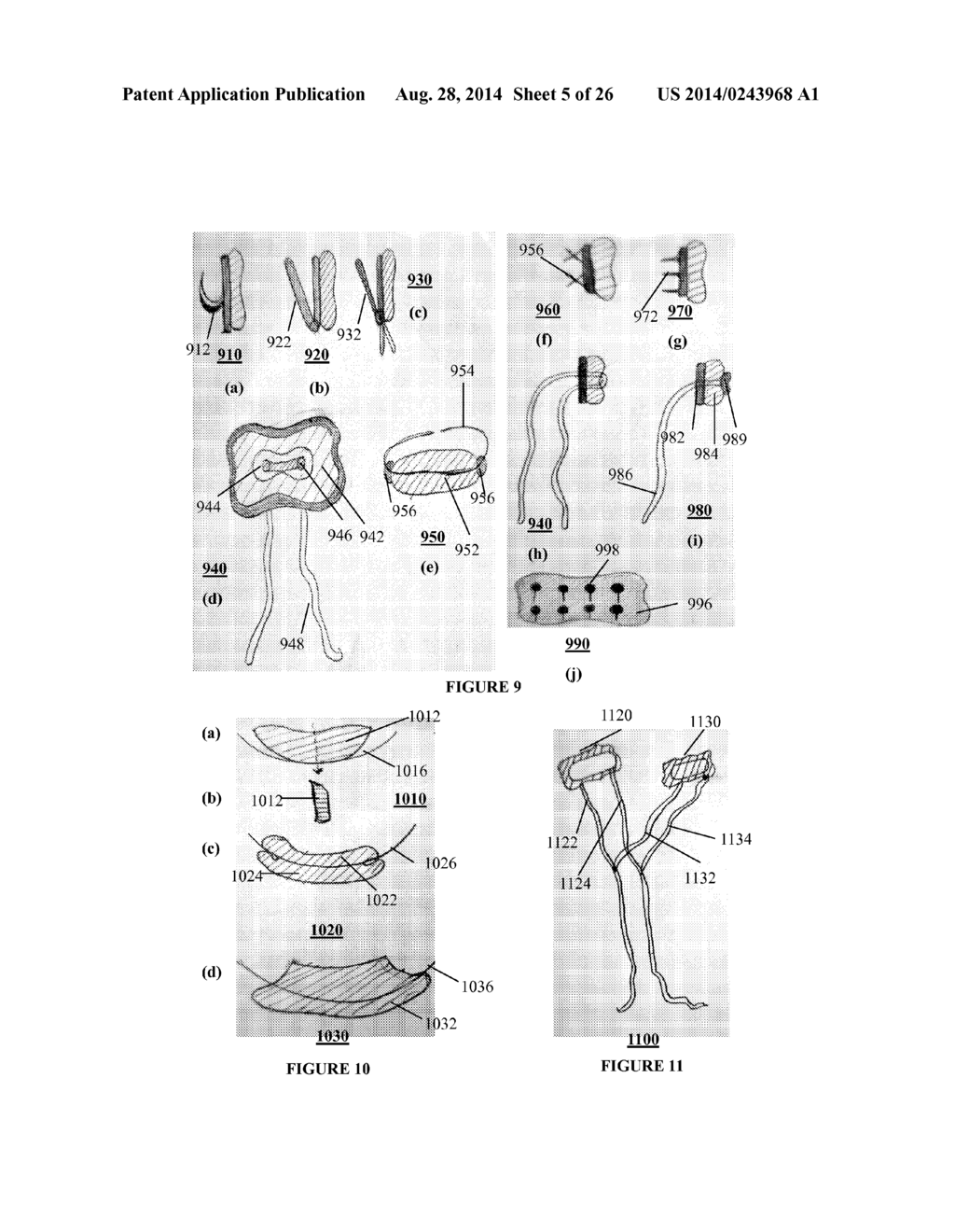 SYSTEMS, DEVICES AND METHODS FOR REPAIR OF HEART VALVE LESIONS - diagram, schematic, and image 06