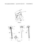 SYSTEMS, DEVICES AND METHODS FOR REPAIR OF HEART VALVE LESIONS diagram and image