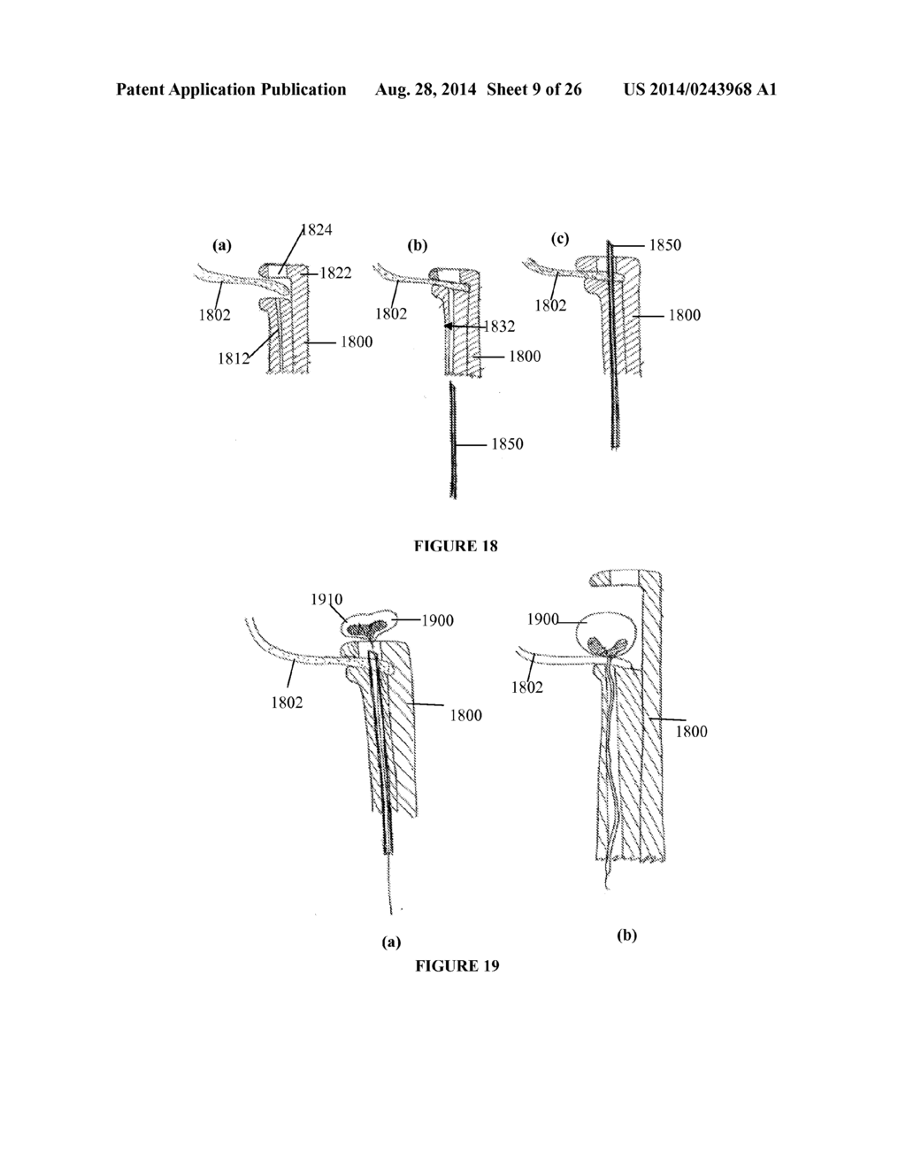 SYSTEMS, DEVICES AND METHODS FOR REPAIR OF HEART VALVE LESIONS - diagram, schematic, and image 10