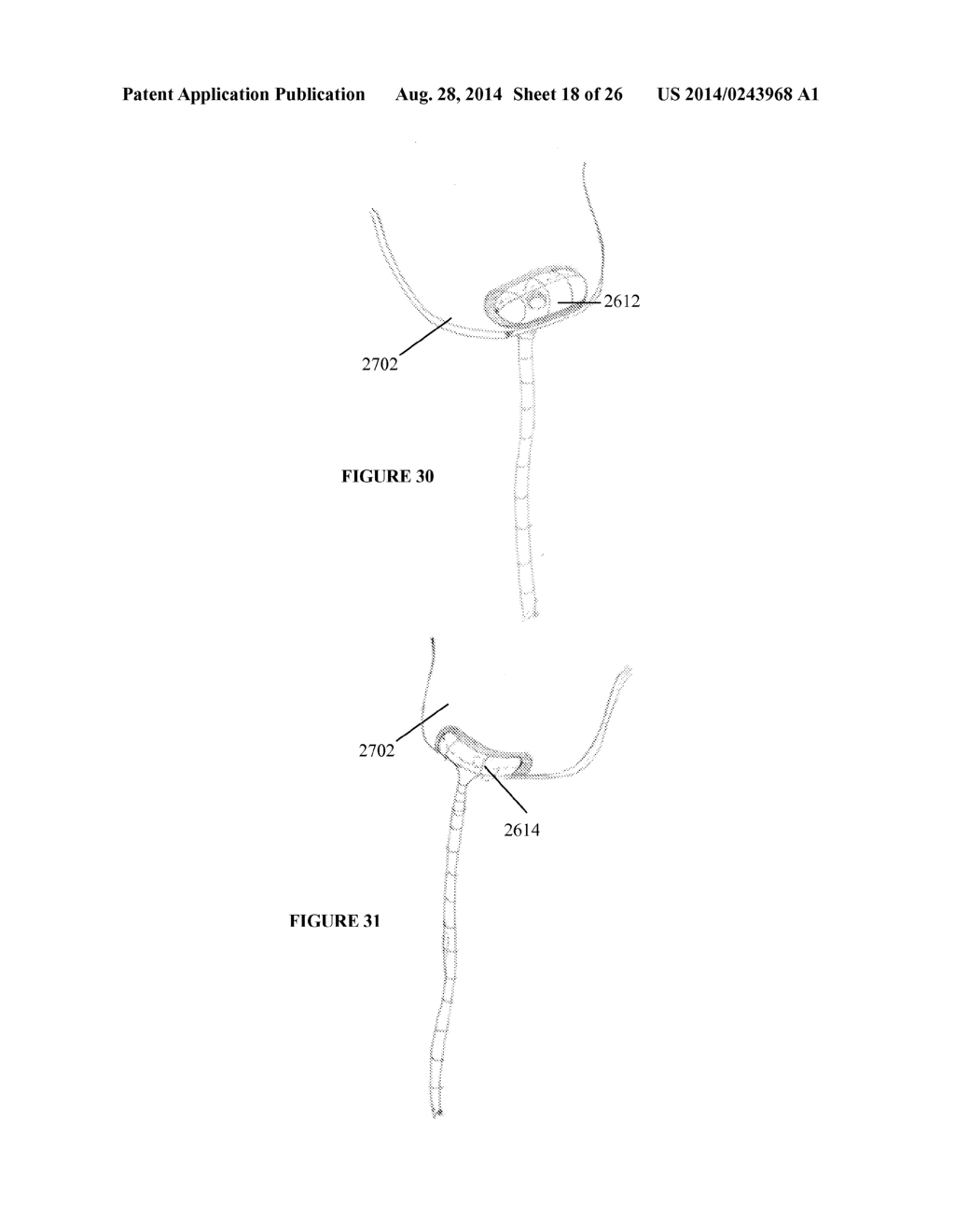 SYSTEMS, DEVICES AND METHODS FOR REPAIR OF HEART VALVE LESIONS - diagram, schematic, and image 19