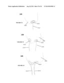 SYSTEMS, DEVICES AND METHODS FOR REPAIR OF HEART VALVE LESIONS diagram and image