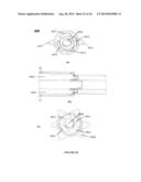 SYSTEMS, DEVICES AND METHODS FOR REPAIR OF HEART VALVE LESIONS diagram and image