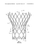 PROSTHETIC HEART VALVE WITH EXPANDABLE MICROSPHERES diagram and image