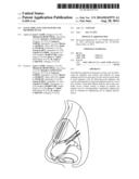 NASAL IMPLANTS AND SYSTEMS AND METHODS OF USE diagram and image