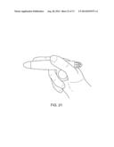 NASAL IMPLANTS AND SYSTEMS AND METHODS OF USE diagram and image