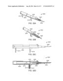 NASAL IMPLANTS AND SYSTEMS AND METHODS OF USE diagram and image