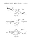 NASAL IMPLANTS AND SYSTEMS AND METHODS OF USE diagram and image