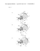 ARTIFICIAL KNEE JOINT IMPLANT diagram and image