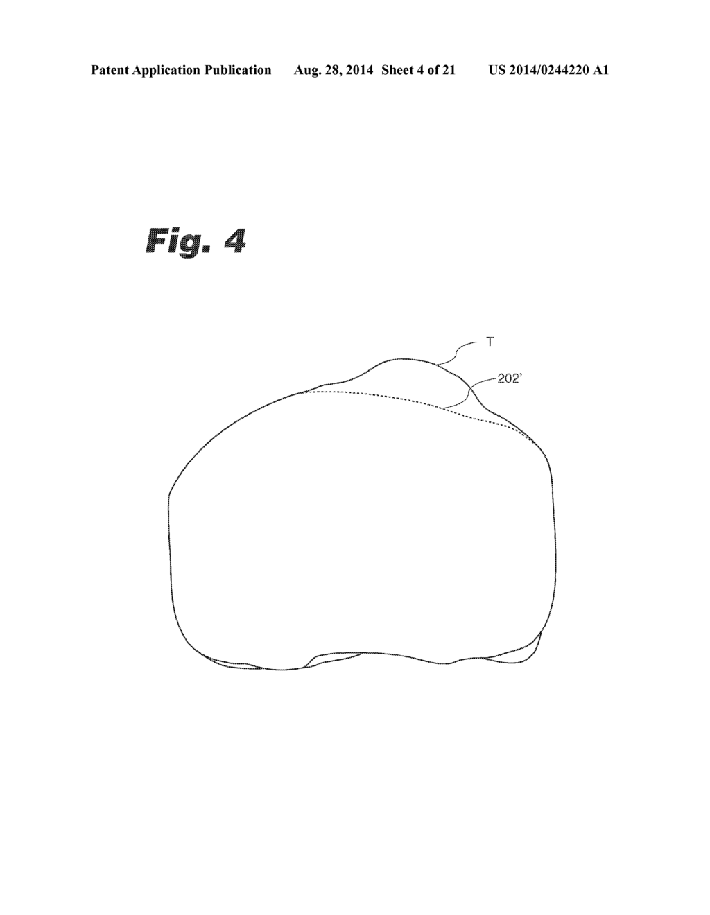 SYSTEMS AND METHODS FOR OPTIMIZING FIT OF AN IMPLANT TO ANATOMY - diagram, schematic, and image 05