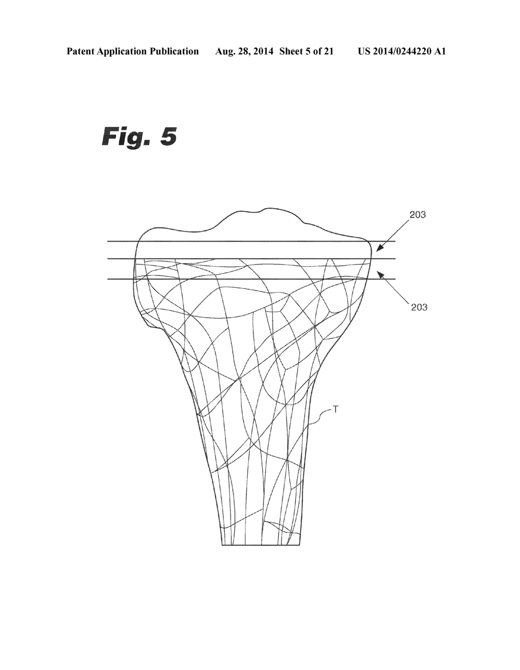 SYSTEMS AND METHODS FOR OPTIMIZING FIT OF AN IMPLANT TO ANATOMY - diagram, schematic, and image 06