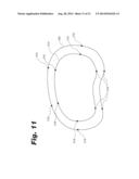 SYSTEMS AND METHODS FOR OPTIMIZING FIT OF AN IMPLANT TO ANATOMY diagram and image